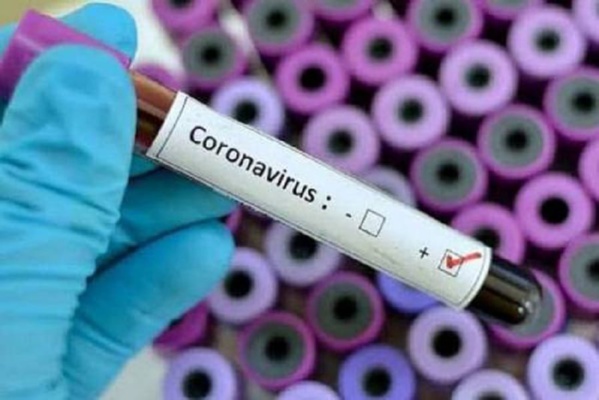 Covid-19 au Sénégal : 291 cas confirmés dont 178 guéris et 2 décès