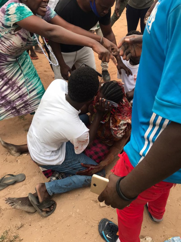 Capskiring : Blessée à l'œil... Qui est Bintou Sèye...?