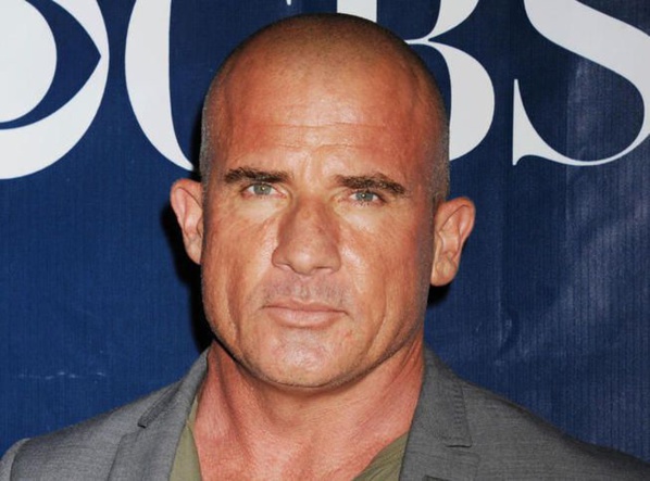 Dominic Purcell défiguré par un accident survenu sur le tournage de Prison Break