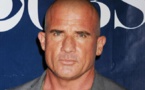 Dominic Purcell défiguré par un accident survenu sur le tournage de Prison Break